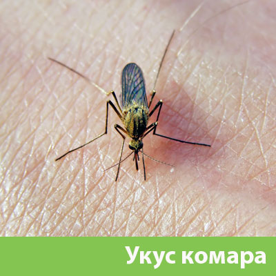Укусы комаров в Зеленограде